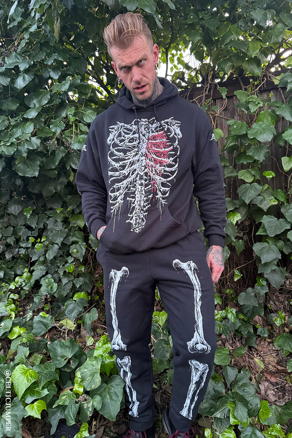 Dead Inside Skeleton Joggers - Image 9